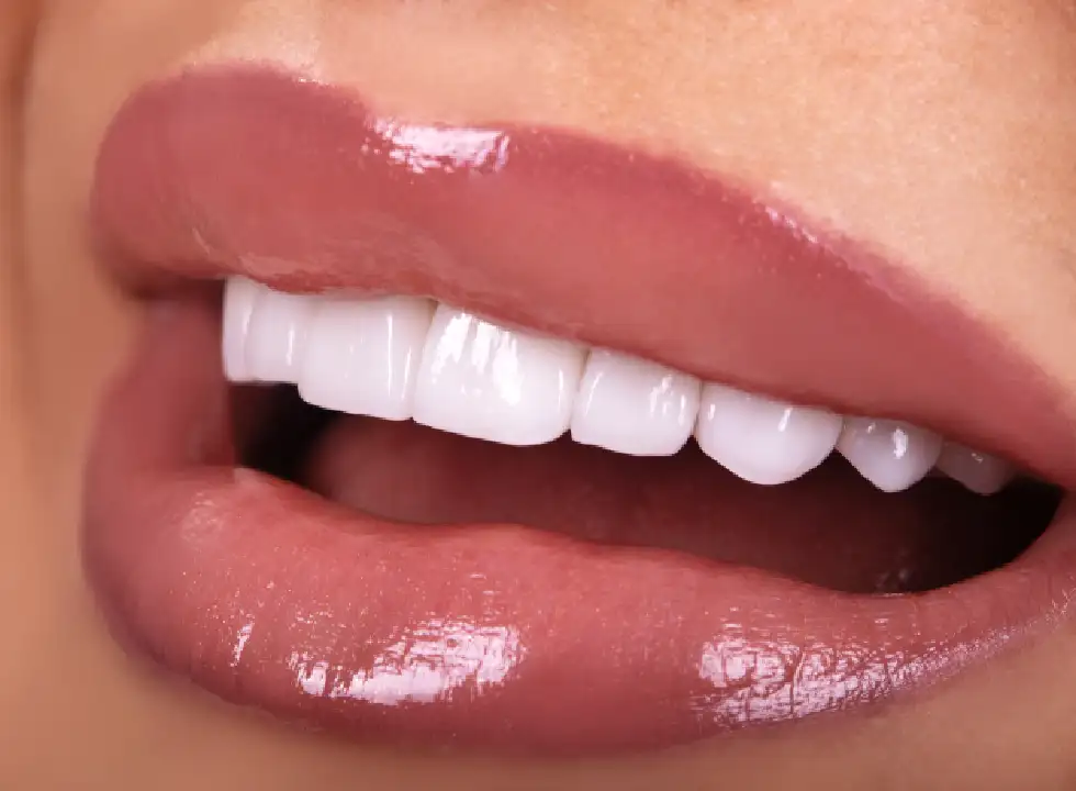 Porcelain Vs. Composite: Which Dental Veneer Is Right For You?